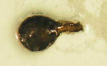 dark microscopic single=celled fungal spore.